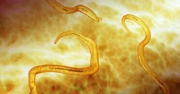 pinworm parazity v lidském těle