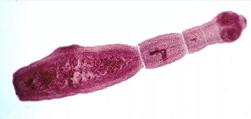 Echinococcus je jedním z nejnebezpečnějších parazitů pro člověka