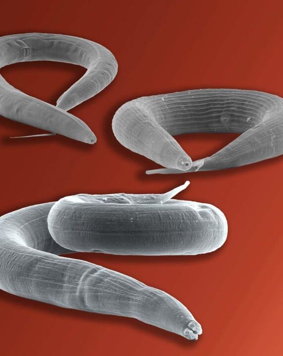 parazit pinworm žijící ve střevě