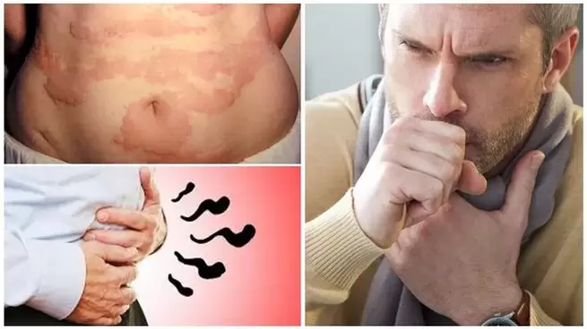 Alergie, kašel a nadýmání jsou příznaky poškození těla červy
