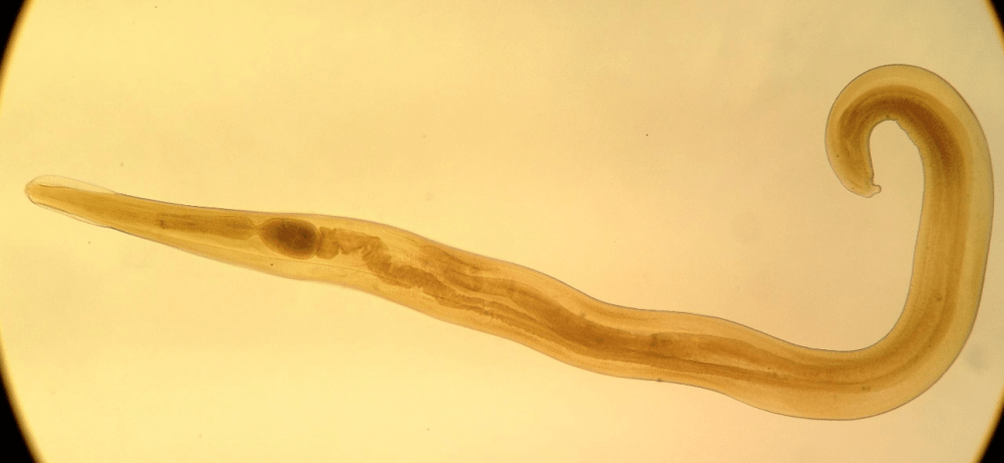 Pinworm je běžný parazit mezi dětmi. 